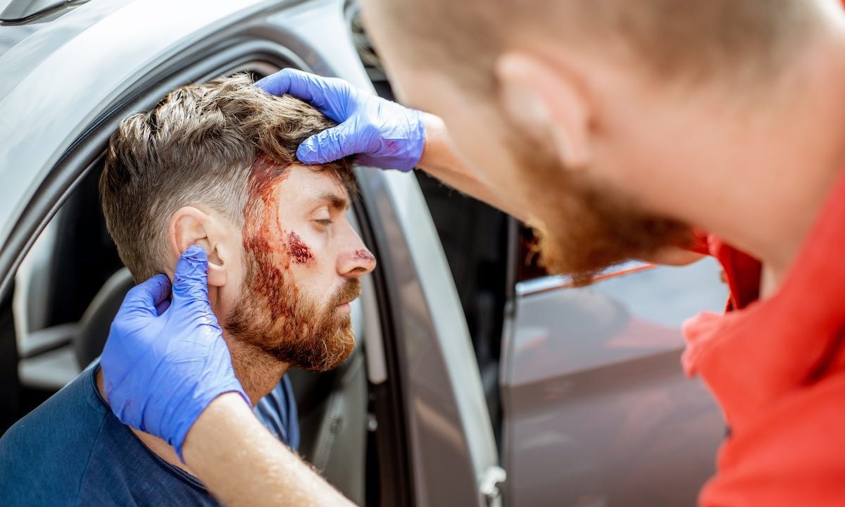 Common Injuries Families Face After Car Accidents