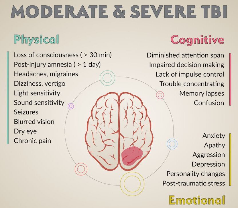 diagnosing-traumatic-brain-injuries