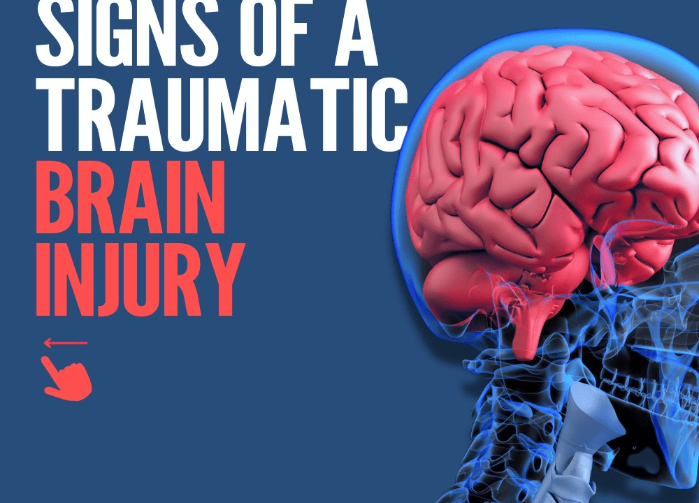 Legal Compensation for Brain Injury Rehabilitation