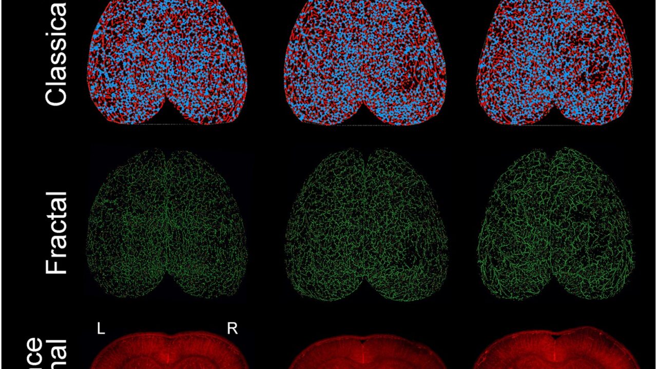 How to Document and Preserve Evidence in TBI Cases