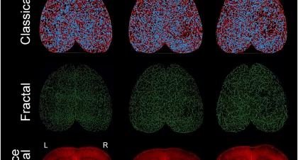 How to Document and Preserve Evidence in TBI Cases