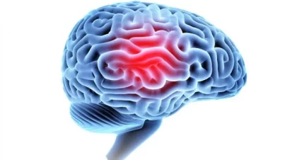 Life Care Plans: A Vital Tool for TBI Recovery