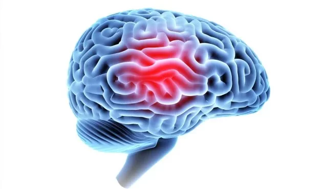 Life Care Plans: A Vital Tool for TBI Recovery-image