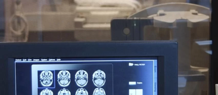 Neurological Testing for Brain Injury Diagnosis-image