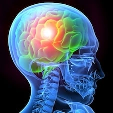 Navigating Insurance Claims After a Brain Injury-image