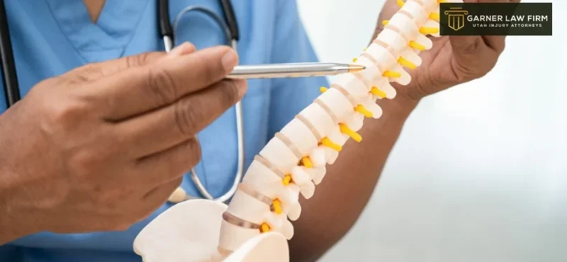 South Jordan Spinal Cord Injury Lawyer-image